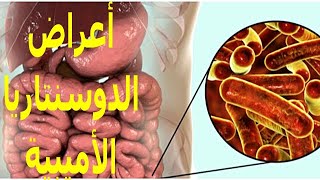 ما هى أعراض الدوسنتاريا المعوية ؟