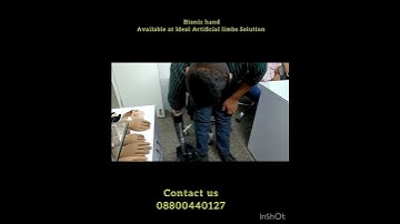 Advance prosthetic arm#pt from IRAQ#08800440127 #bionic hand#sensor hand#prostheticlimb #artificial