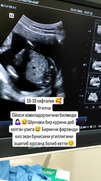 #беременность #узи - YouTube
