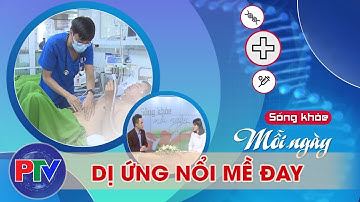Dị ứng nổi mề đay | Sống khỏe mỗi ngày