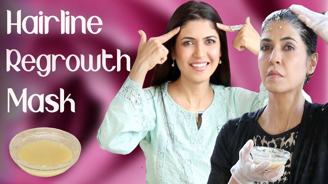 Hairline Regrowth Mask 3 Simple Ingredients/Stop Thinning Hair Ghazal