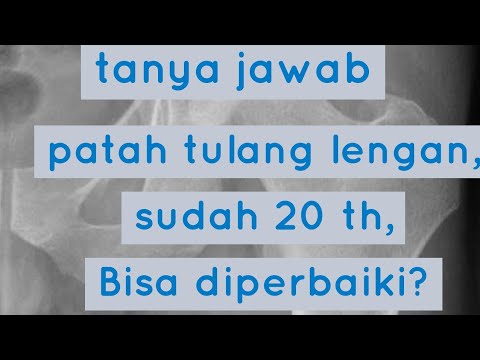 Video: Apakah saya mematahkan humerus saya?