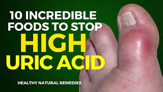 10 Incredible Foods To Stop High Uric Acid