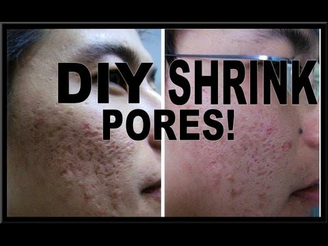 Diy mask to shrink pores