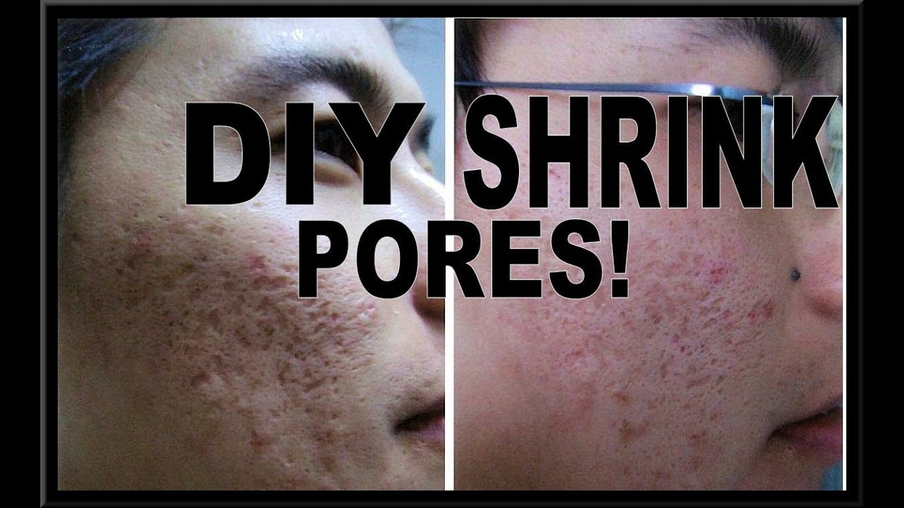 How do you minimize pores?