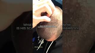 Celebrity No shampoo transformation! Wealth