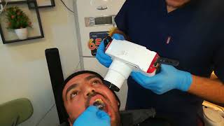 جهاز اشعه الاسنان الحديث screenshot 3