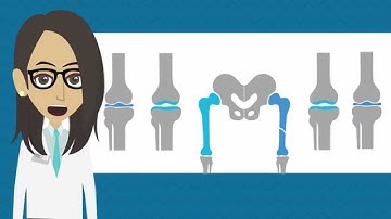 Top 20 Orthopedic ICD 9 to ICD 10 Codes