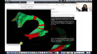 Tractometry Part 4 - BUAN - Demo on Parkinson’s data