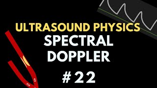 Spectral Doppler Ultrasound | Ultrasound Physics Course | Radiology Physics Course #22