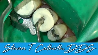 Dental Assisting - How to Make IRM