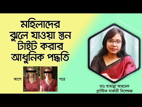 ভিডিও: স্তন ঝুলে যাওয়া বন্ধ করার 3 টি উপায়