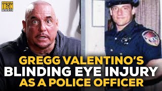 How Gregg Valentino Blinded His Eye During His Time As A Cop