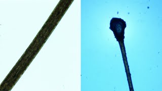 Human Hair Under A Microscope