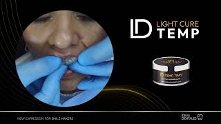 Provisionales para carillas con ID Light Cure System