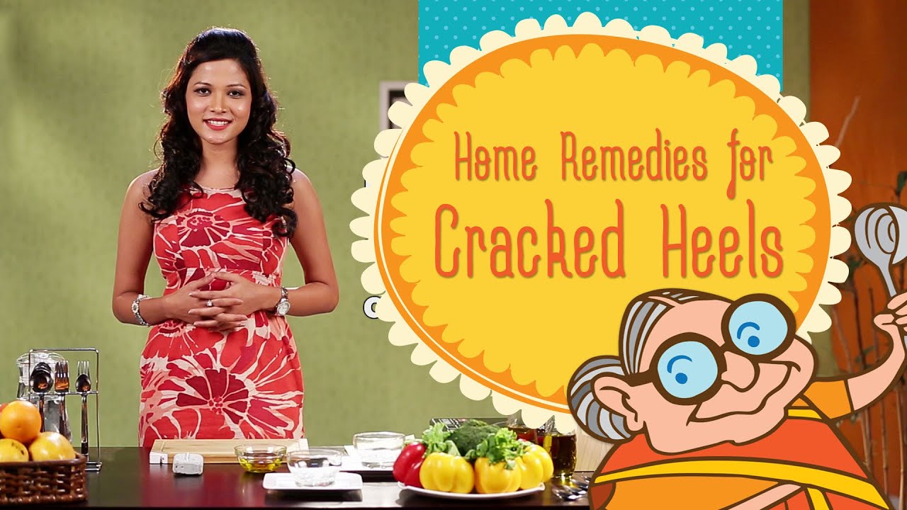 Cracked Heels: Treatment And Ayurvedic Home Remedies