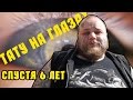 ТАТУ НА ГЛАЗАХ спустя 6 лет заключение доктора