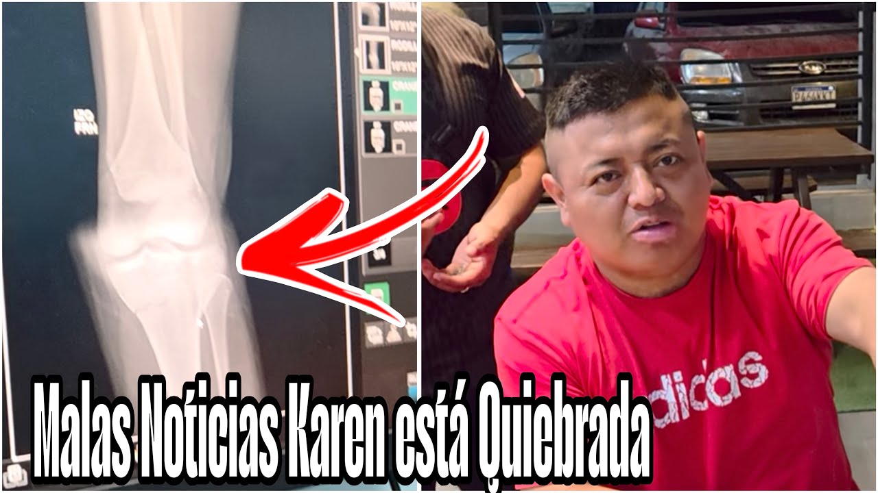 Malas Noticias Karen Está Quiebrada|Quedara En Silla De Ruedas Para Siempre|Mira La Radiografía 