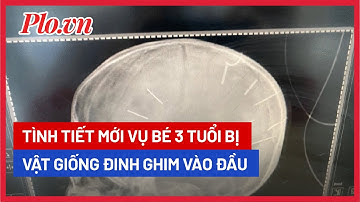 Tình tiết mới vụ bé 3 tuổi bị vật nhọn ghim vào đầu - PLO