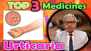 Top 3 - Homeopathy Medicines for Urticaria - Dr P. S. Tiwari