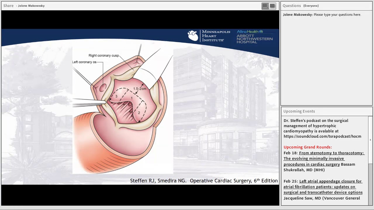 Роберт Штеффен — Хирургическое лечение гипертрофической кардиомиопатии — 11 февраля 2019 г.