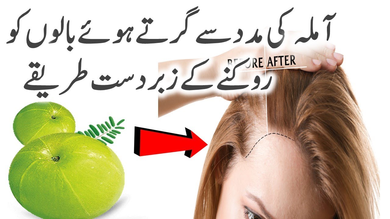 Amla for Hair Growth in urdu | Hair Growth Tips - YouTube