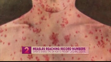 How to protect yourself from the measles
