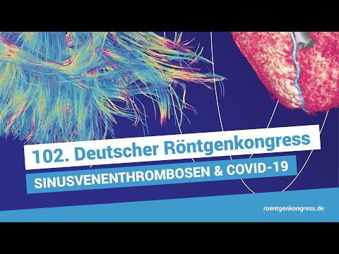 Sinusvenenthrombosen in Zeiten von COVID 19: Pathophysiologie, Diagnostik und Therapie