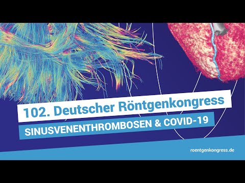 Video: Sinus-Röntgen: Zweck, Verfahren Und Risiken