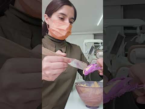 #alginato #impresiondental #yeso #dientes #dentista