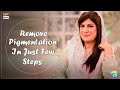 Watch Pigmentation Ka Ilaaj Ab Bohat Aasan - Dr. Bilquis Online In Hd