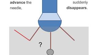 Why I can not see the needle tip by using a curved transducer?