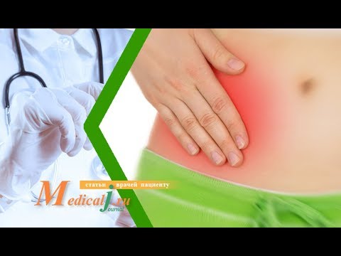 Как болит аппендицит: симптомы и лечение