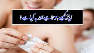 What is Hiv AIDS In Urdu? How does AIDS happen? ایڈزکیا ہے اور کیسے ہوتا ہے