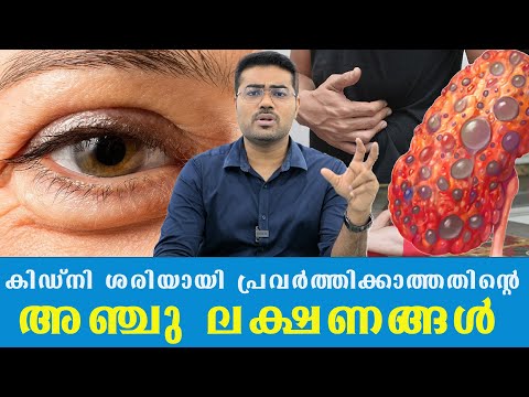 കിഡ്നി ശരിയായി പ്രവർത്തിക്കാത്തതിന്റെ അഞ്ചു ലക്ഷണങ്ങൾ /Dr Manoj Johnson