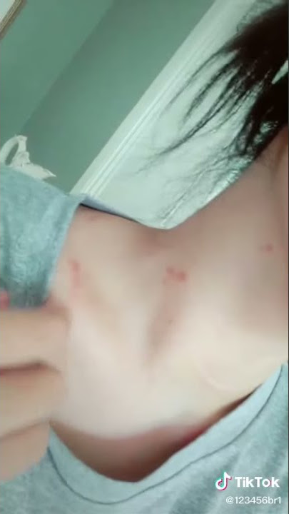 Tik Tok Abg Gatel Kena Jamur