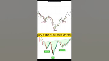 Head and Shoulder Pattern #trading #stockmarket #forex #candlestickpattern #nifty #chartpattern