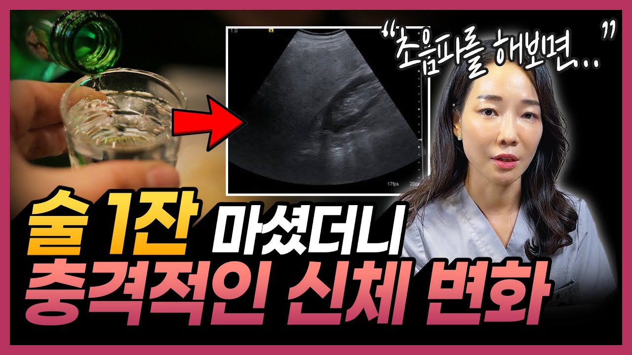 술 끊은 사람들의 3가지 공통점 | 술 한잔이 우리 몸에 미치는 놀라운 영향