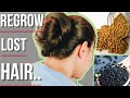 DIY Hair Growth Oil | Fenugreek oil for hair Growth | Coconut Oil Aloe Vera & Kalonji For Hair