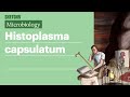 Histoplasma capsulatum | USMLE Step 1 | Sketchy Medical