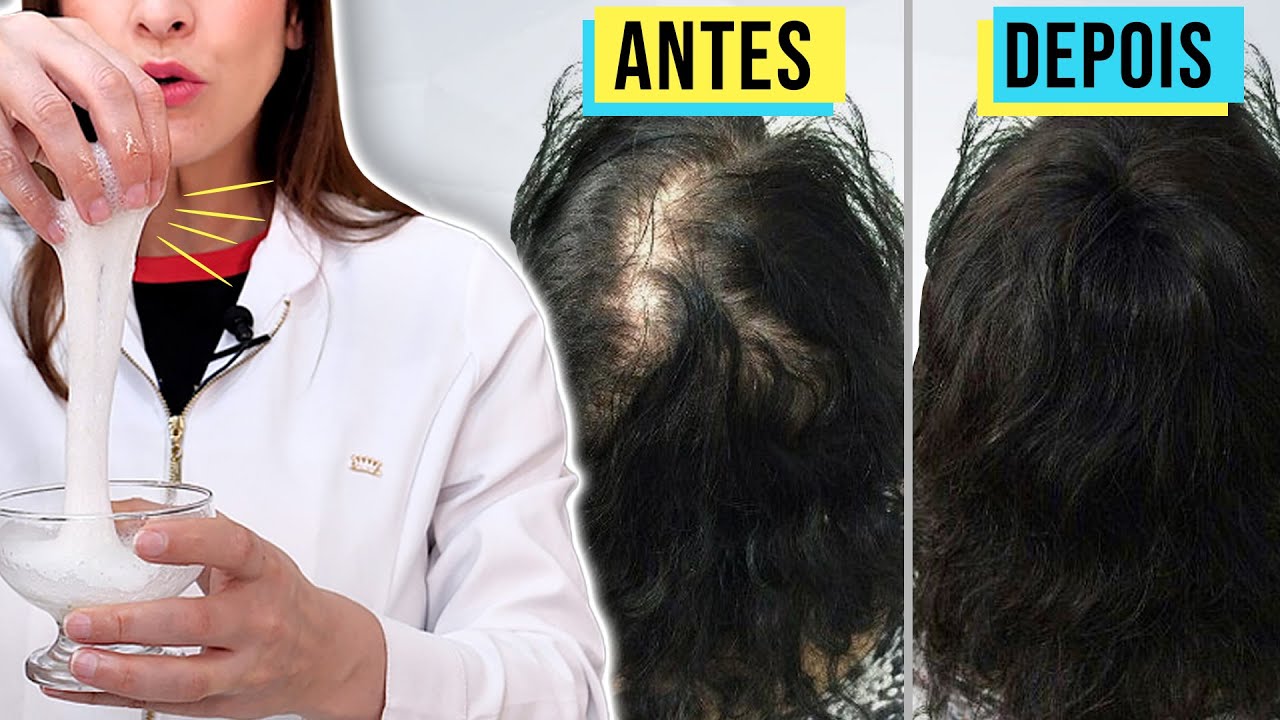 11 dicas de como tratar o cabelo caindo