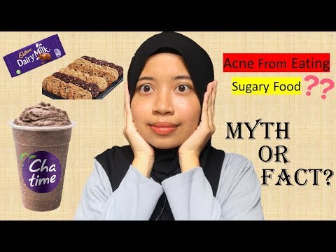 Does Sugar Cause Acne? | My Brother&#;s Experience!