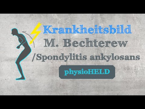 physioHELD: Morbus Bechterew | Spondylitis ankylosans | Rheuma