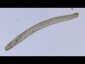 Инфузория. Спиростомум. Spirostomum. Вода из озера под микроскопом