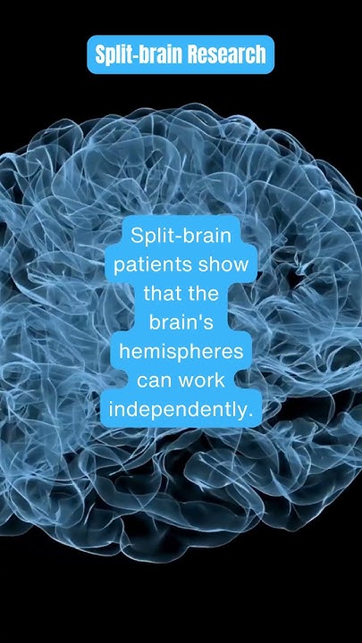 Split Brain Research Demonstrates What Important Aspect Of Brain Function Split-Brain Research: Can Your Brain Function Independently? #shorts #