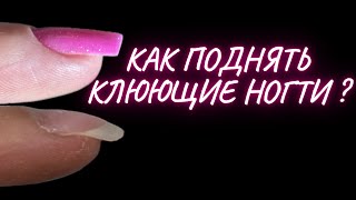 КАК ПОДНЯТЬ КЛЮЮЩИЕ НОГТИ? Коррекция гелем тонко!