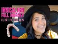 What It's Like to Have Invisalign - Things I Wish I Had Known!