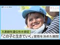 「一生、この子と生きていく」妊娠中に“水頭症”と告げられた我が子・・・4歳の今、成長の日々と新たな一歩
