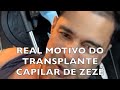 Real motivo do transplante capilar de zez