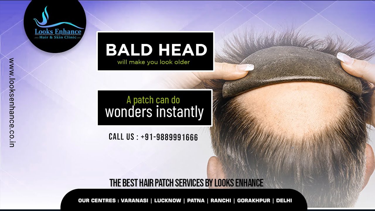 Men's Hair Patch Ranchi Hair Weaving in Ranchi Hair Bonding in